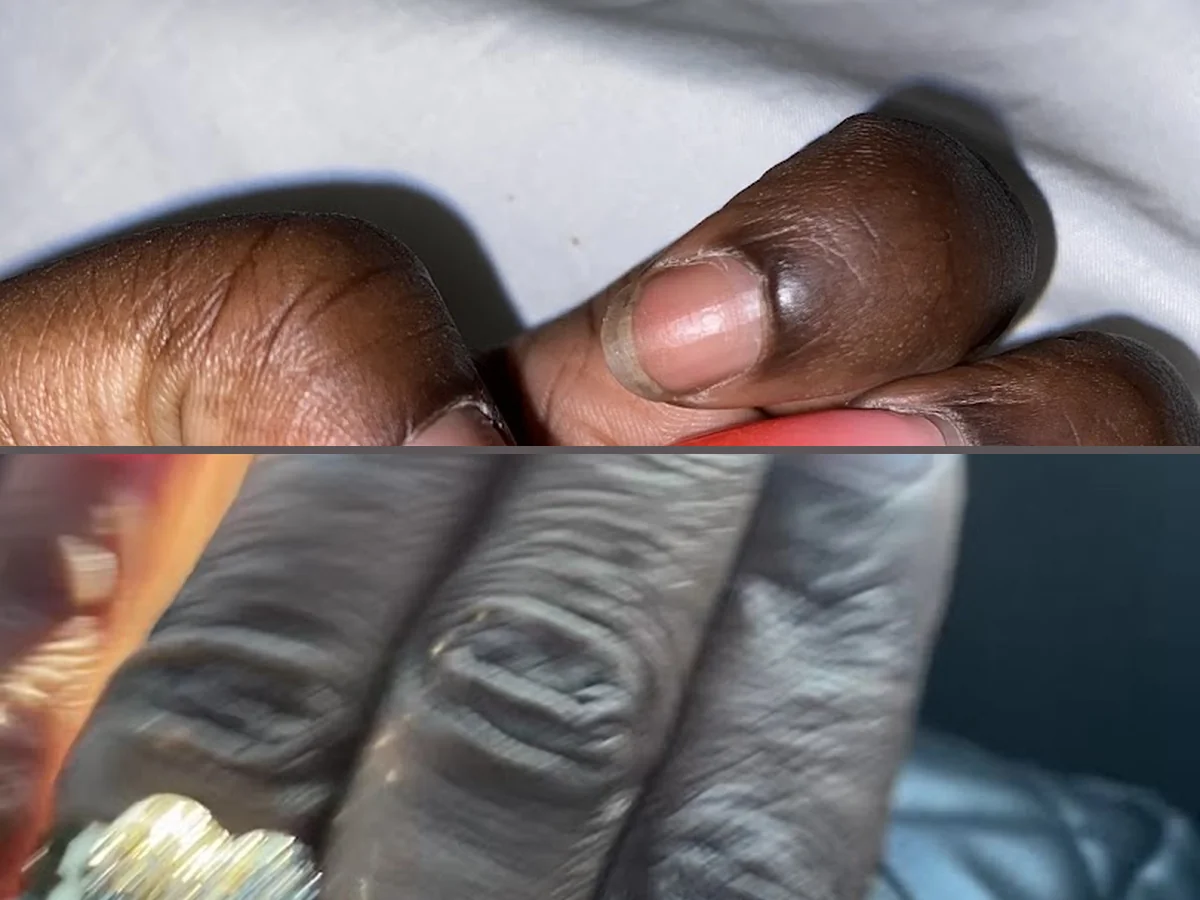 Nail Care in Orlando